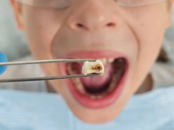 Best Tooth Pain Emergency Relief  in Newton, IL
